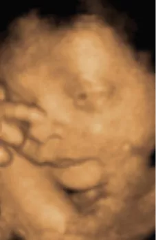 Will the baby feel the ultrasound | Ultrasound Care