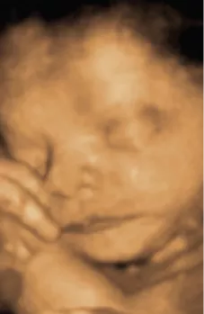 Will the baby feel the ultrasound | Ultrasound Care